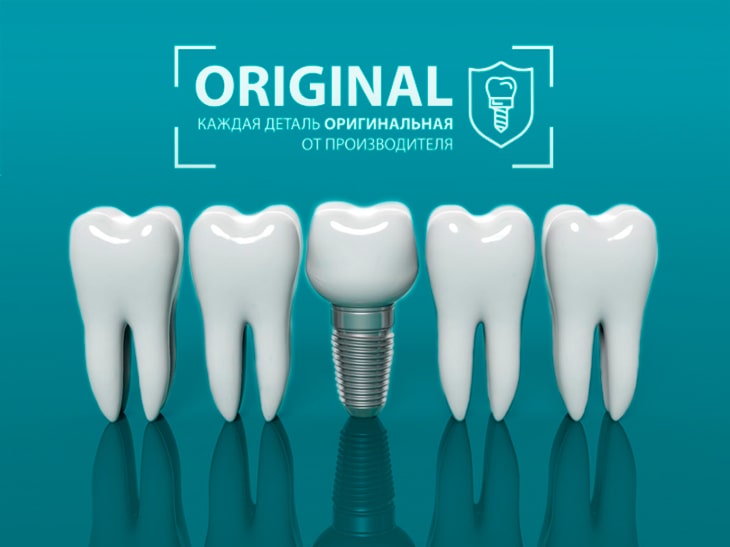 4 правила, как проверить оригинальность зубных имплантатов. Оригинал vs Подделка.