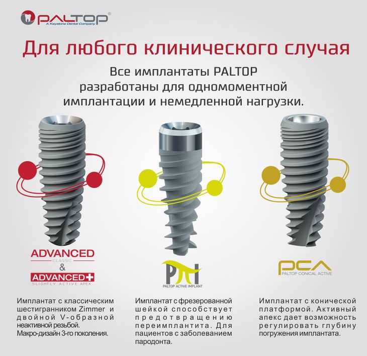 Особенности различных имплантационных систем презентация